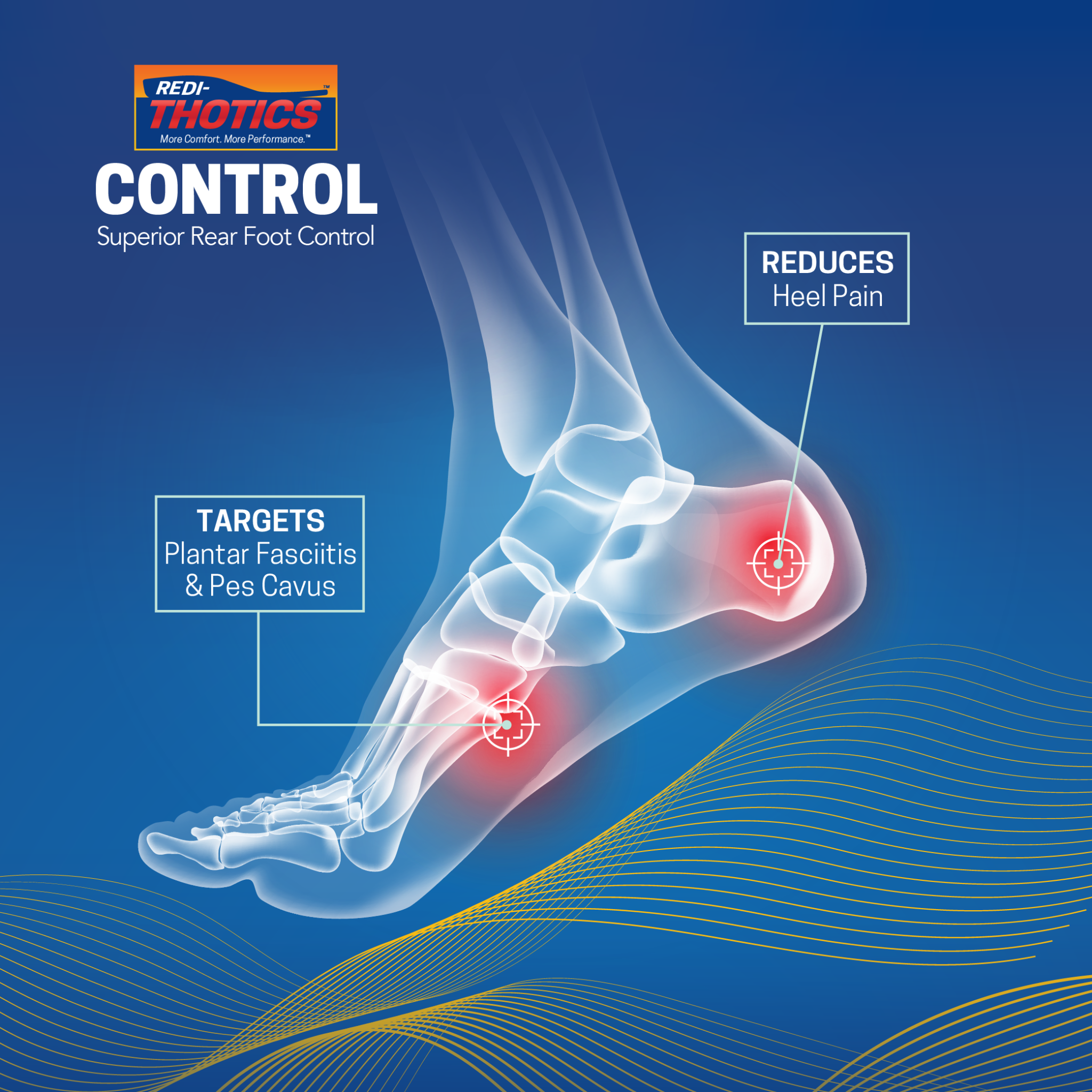 Redi-Thotics Control™